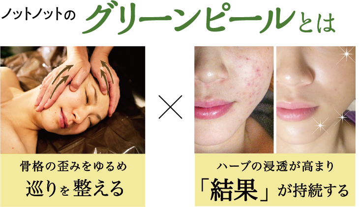ノットノットのグリーンピールとは